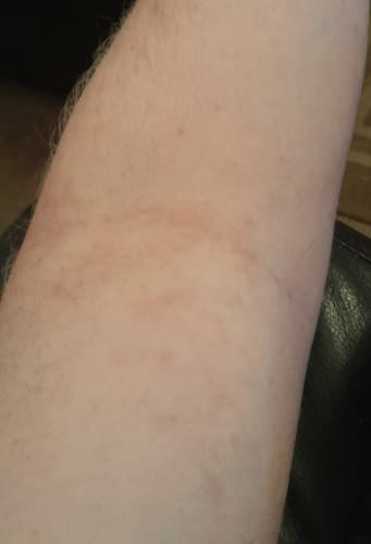 Customer photo review of Seb Natural Calming Serum