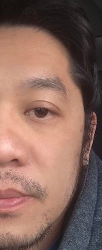 Customer photo review of Seb Natural Calming Serum