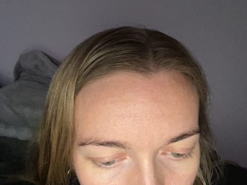 Customer photo review of Seb Natural Soothing Balm