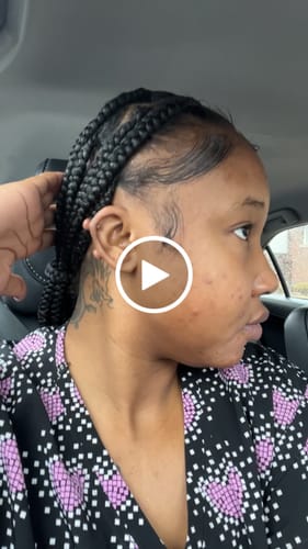Customer video review of LIMITED EDITION: Jolie’s Mini Full Body & Face Brightening Kit/ Acne Kit