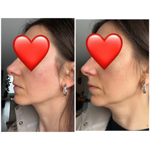 Customer photo review of Legacy Youth Elixir