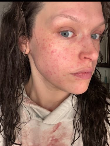 Customer photo review of Legacy Youth Elixir