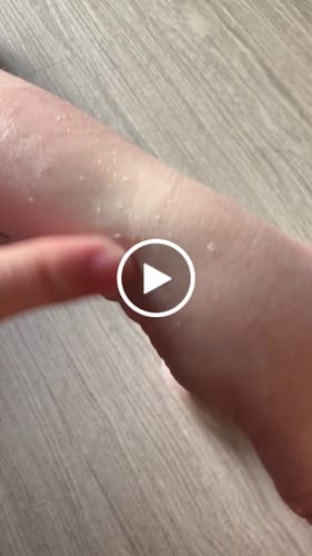 Customer video review of Keana Baking Soda Moist Peeling 200ml