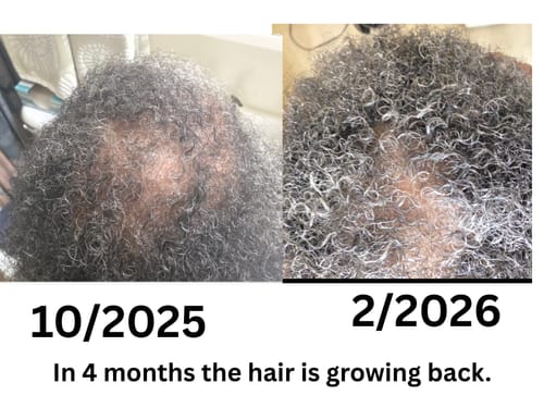 Customer photo review of 4 oz CAFFEINE HAIR GROWTH BUTTER