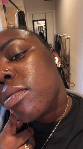 Customer photo review of Turmeric Skin Care Set