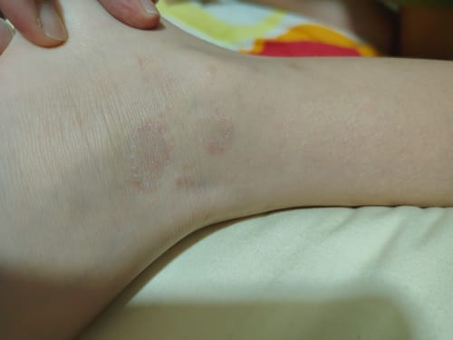 Customer photo review of Jolicare Cream