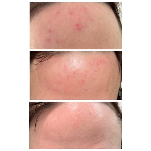 Customer photo review of The Rescue Mist Range