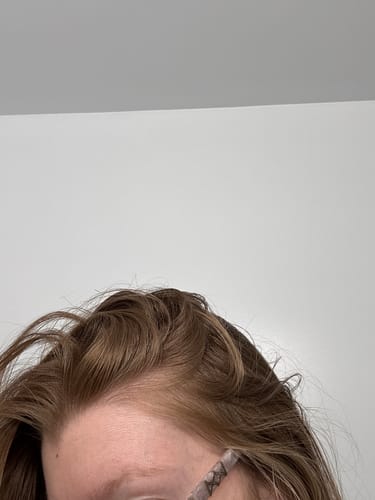 Customer photo review of Pre-Wash Scalp Oil by TR