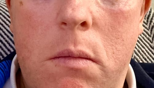 Customer photo review of Seb Natural Soothing Balm