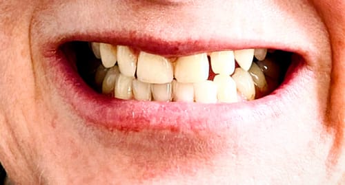 Customer photo review of Toothpaste Starter Pack