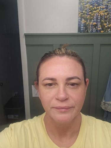Reviewer's selfie showing glowing skin after using the Seranova Micro Infusion System.