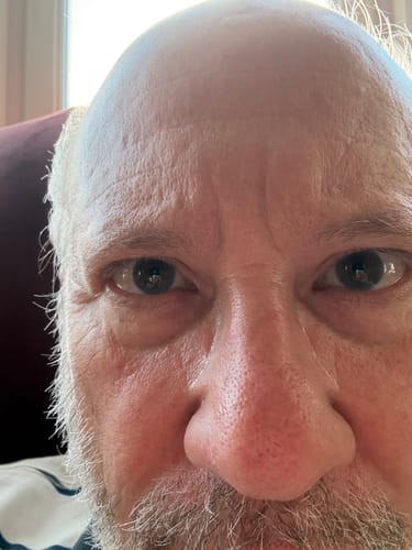 Customer photo review of Seb Natural Calming Serum