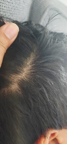 Customer photo review of Seb Natural Calming Serum