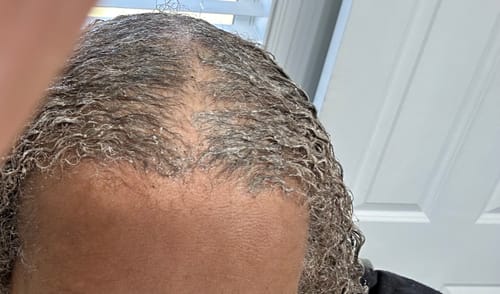 Customer photo review of Chebe Powder 50g | Traditional African Hair Growth Treatment