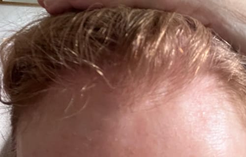 Customer photo review of Seb Natural Calming Serum