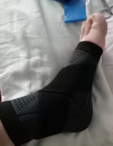 Customer photo review of Ankle Support Brace