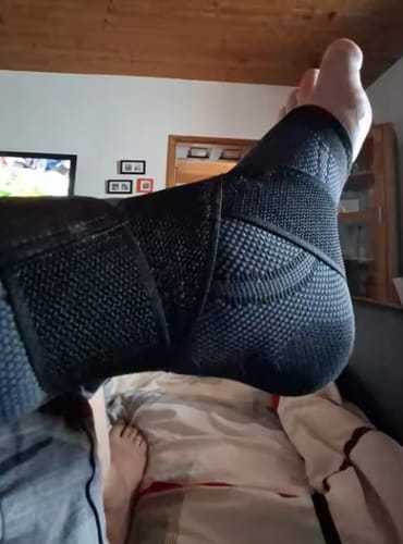 Customer photo review of Ankle Support Brace