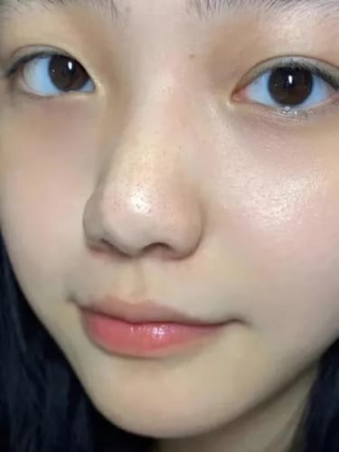 Customer photo review of Y-Axis Dark Spot Correcting Serum