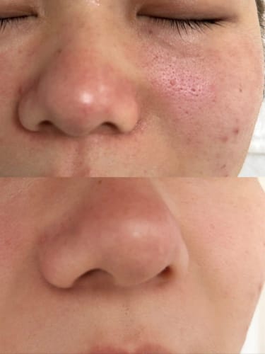 Customer photo review of Y-Axis Dark Spot Correcting Serum