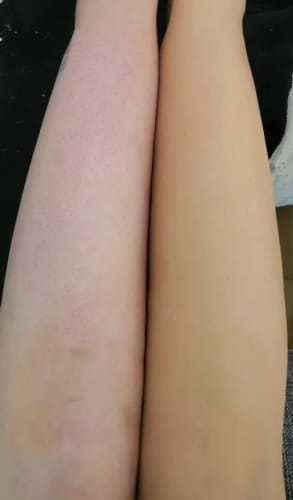 Customer photo review of Lumi Legs