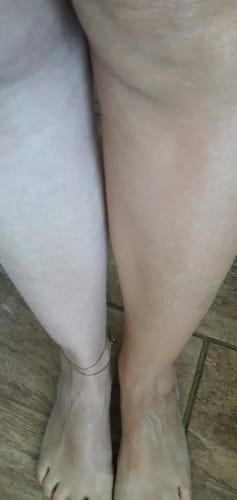 Customer photo review of Lumi Legs
