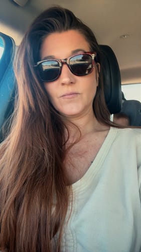 Reviewer showing her face and chest skin after using the Seranova Micro Infusion System.