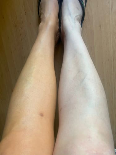 Customer photo review of Lumi Legs