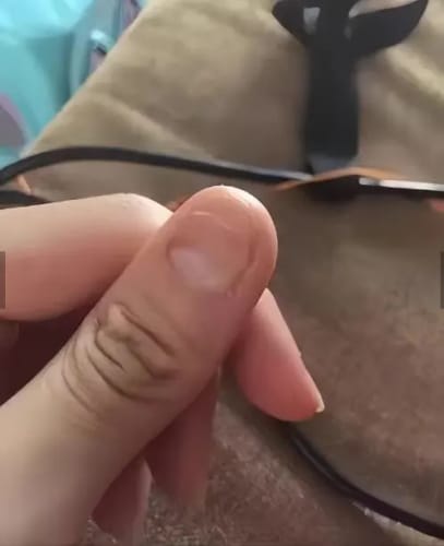 Customer photo review of Nail Care Pen