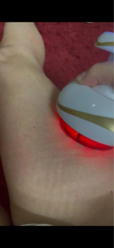 Customer photo review of Avernea SmoothCurve Anti-Cellulite Massager
