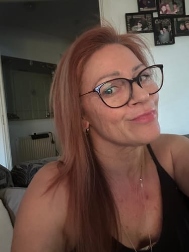 Customer's selfie showing her facial skin after using the Micro Infusion System.