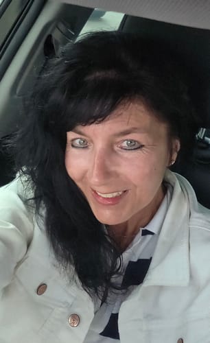 Reviewer showing her smooth facial skin after using The Micro Infusion System, highlighting results around her eyes and forehead.