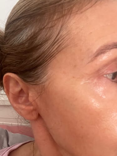 Customer photo review of K-Secret - Crème pour les yeux SEOUL 1988 Rétinal Liposome 4% + fève fermentée - 30ml