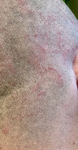 Customer photo review of Seb Natural Calming Serum