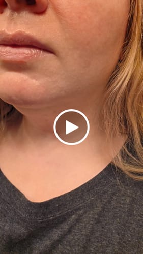 Customer video review of EGF Blue Youth Activating Drop