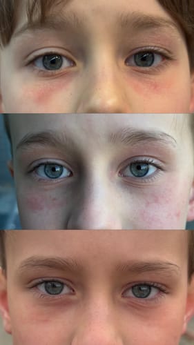 Customer photo review of Seb Natural Calming Serum