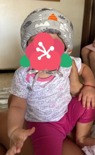 Customer photo review of Gorro protector antigolpes para bebé