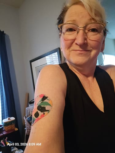 Customer photo review of Skin Grip Original - Medtronic Guardian/Enlite Adhesive Patches