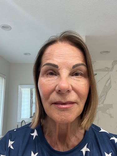 A close-up of the customer's face showing her skin's appearance after using F-Balm.