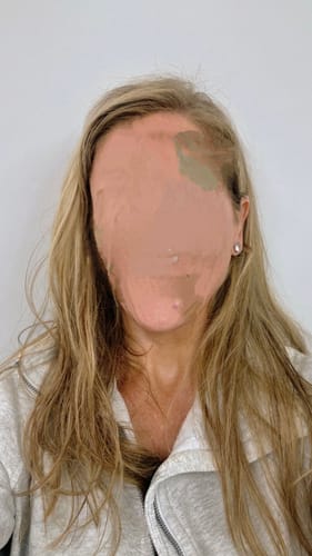 Customer photo review of PeptiBoost Multi-Peptide Hair Serum