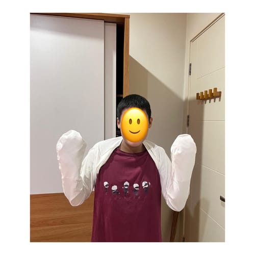 Customer photo review of Eczema Scratch Mitten