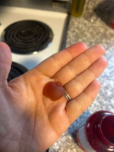 Customer photo review of Apple Cider Vinegar Gummies