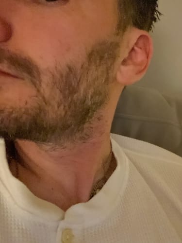 Customer photo review of Seb Natural Soothing Balm