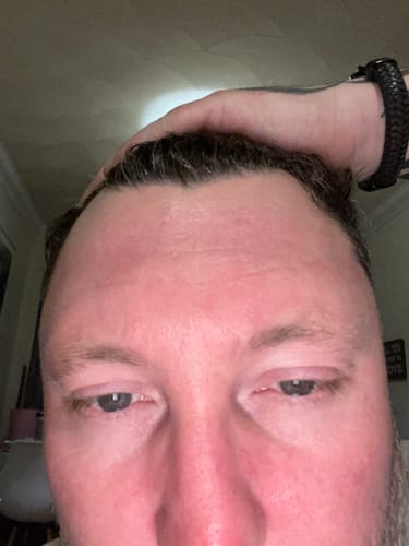 Customer photo review of Seb Natural Calming Serum