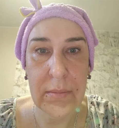 Customer photo review of Thriven Collagen Jelly Cream