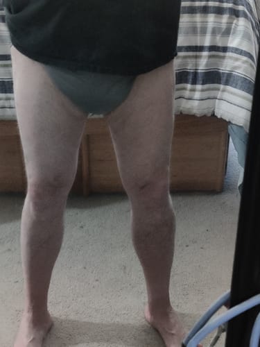 Customer photo review of SUNKISS Masterpiece Adult Diapers With Tabs