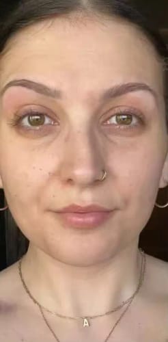 Customer photo review of Thriven Collagen Jelly Cream