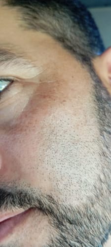 Customer photo review of PhantoMen Crema Anti-edad con Retinol+ para Hombre.
