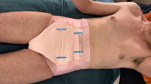 Customer photo review of SUNKISS Masterpiece Adult Diapers With Tabs