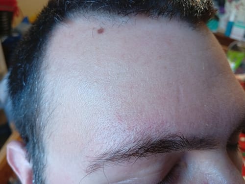 Customer photo review of Seb Natural Calming Serum