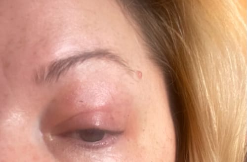 Customer photo review of Seb Natural Calming Serum
